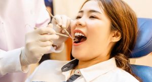 What Is Composite Bonding?