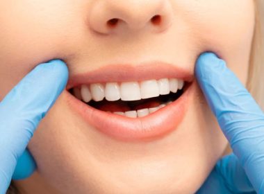 Why More Patients Are Choosing Composite Bonding & How to Get Started?