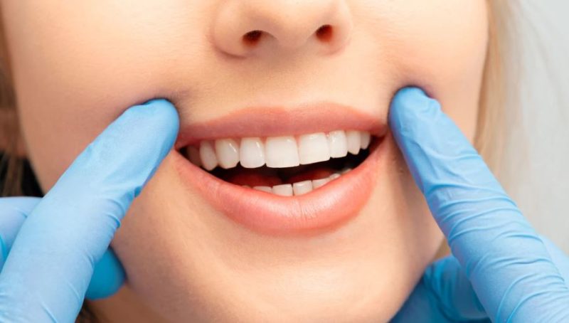 Why More Patients Are Choosing Composite Bonding & How to Get Started?