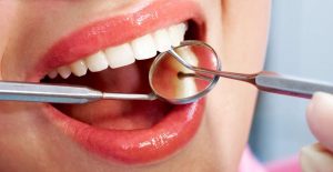 Scalers & Excavators