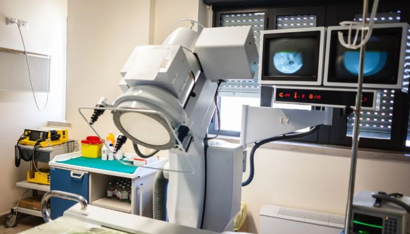 Comparing ESWL and PCNL Procedures for Kidney Stones
